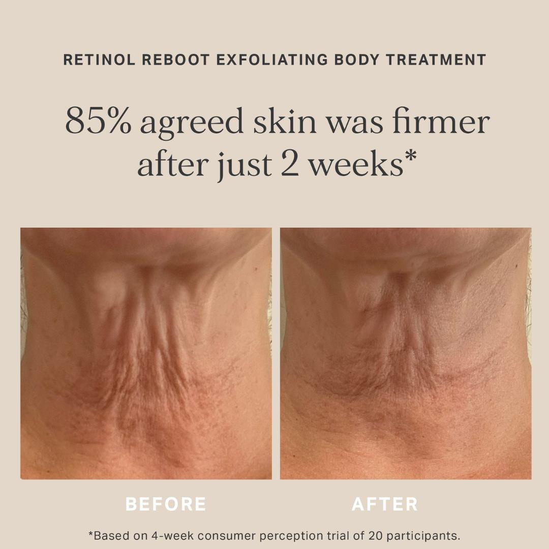 Alpha-H Retinol Reboot Exfoliating Body Treatment, 120ml