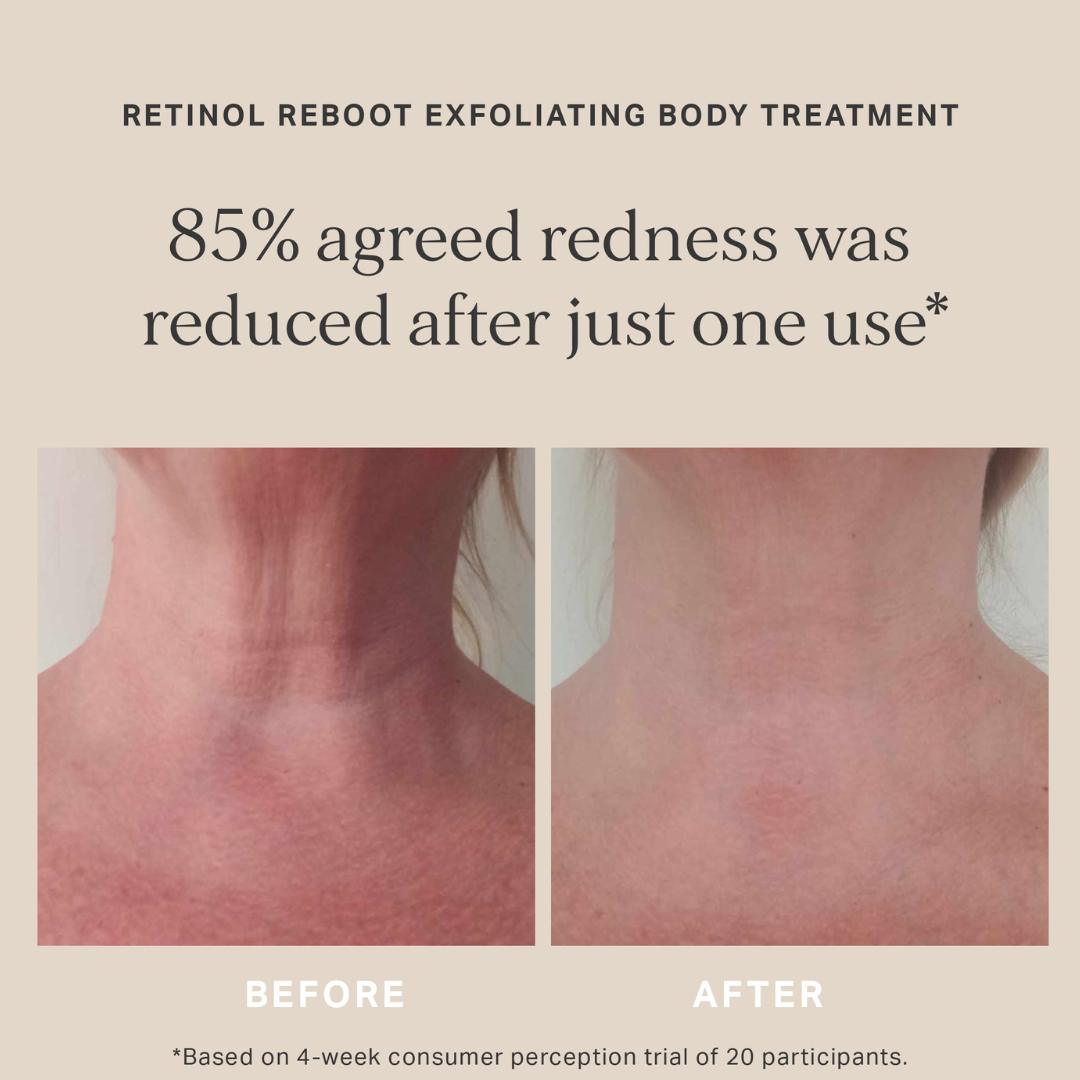 Alpha-H Retinol Reboot Exfoliating Body Treatment, 120ml